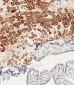 HLA-G Antibody (Center)